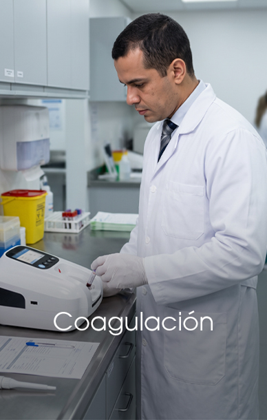 Coagulación 1